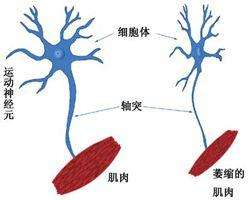 運(yùn)動(dòng)神經(jīng)元病