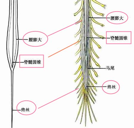 馬尾神經(jīng)綜合癥