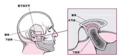 顳下頜關(guān)節(jié)病