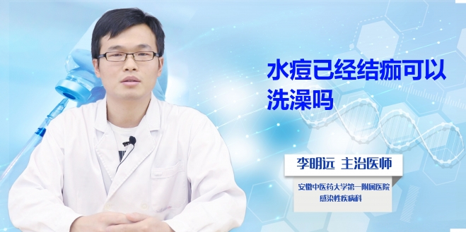 水痘已經結痂可以洗澡嗎？